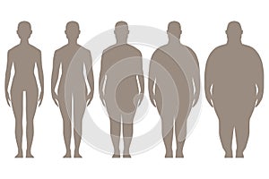 Stages of obesity, the process of obesity.